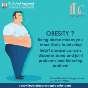 obesity surgery Indore