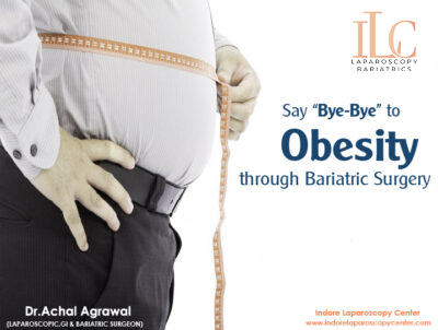 obesity surgery Indore