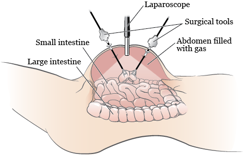 bariatric surgeon Indore