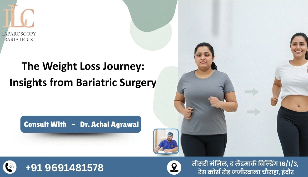 The Weight Loss Journey Insights from Bariatric Surgery