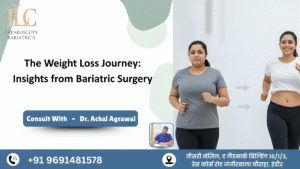 The Weight Loss Journey Insights from Bariatric Surgery