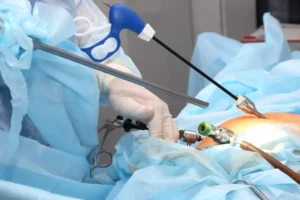 bariatric surgeons in Indore