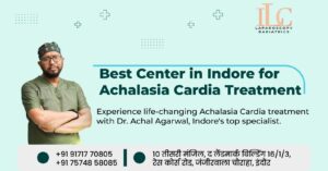 Achalasia Cardia Treatment