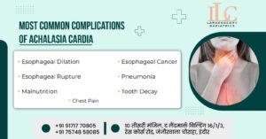 Achalasia Cardia