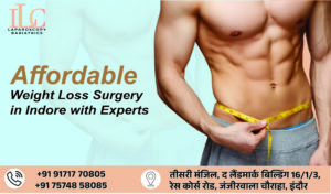 Weight loss surgery