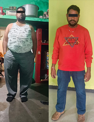 Before/ After