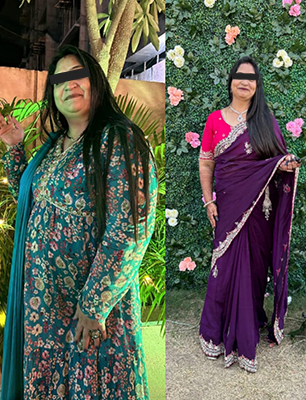 Before/ After