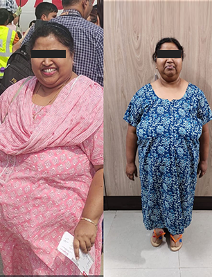 Before/ After