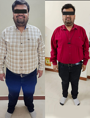 Before/ After