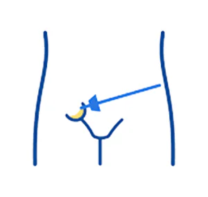 Laparoscopic Surgeon in Indore