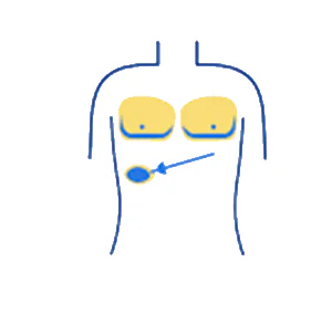 Laparoscopic Surgeon in Indore