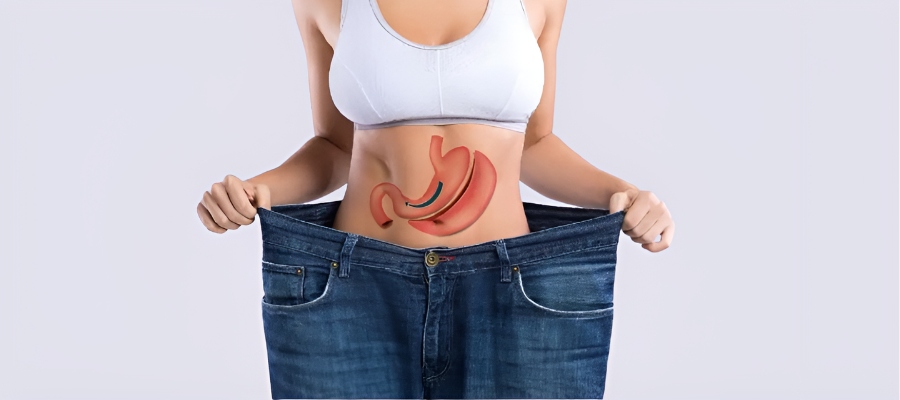 weight losss surgery