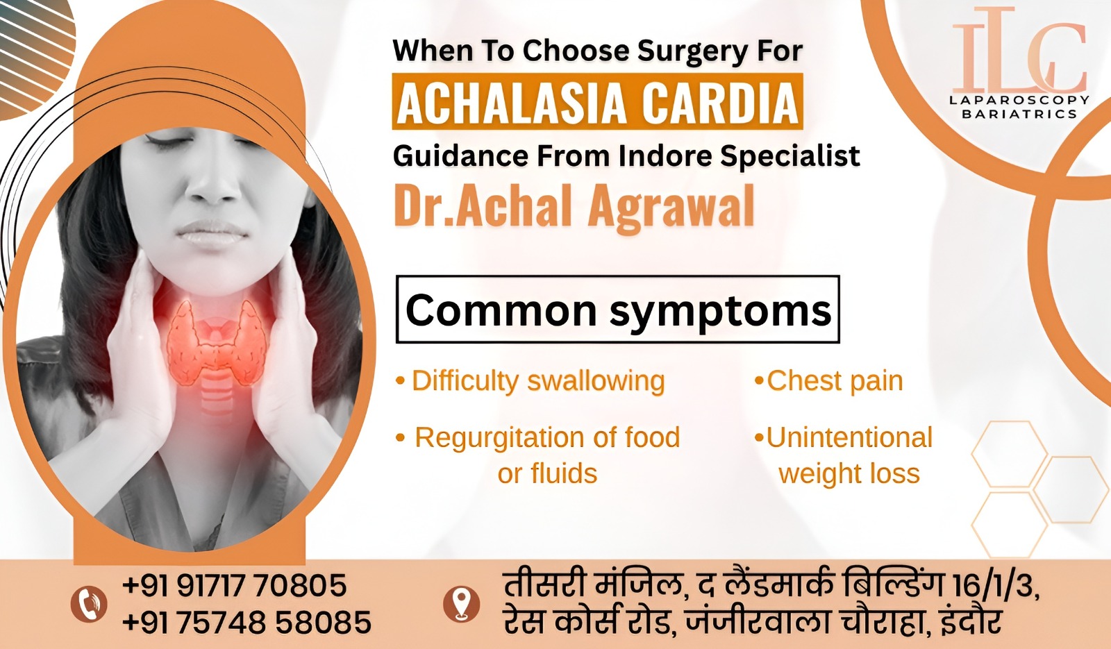 Achalasia Cardia
