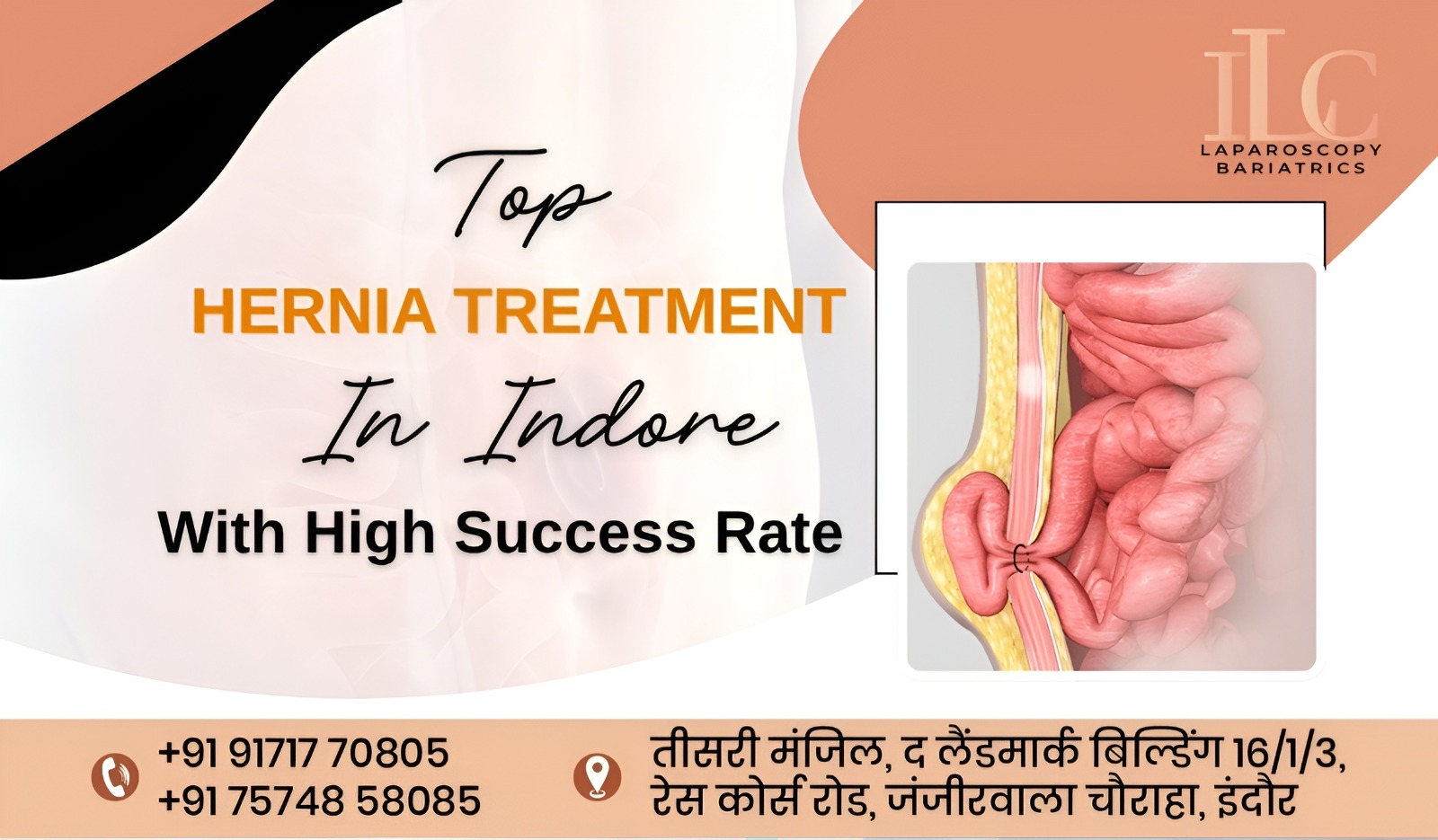 Top Hernia Treatment in Indore with High Success Rates