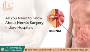 Hernia Surgery in Indore Hospitals