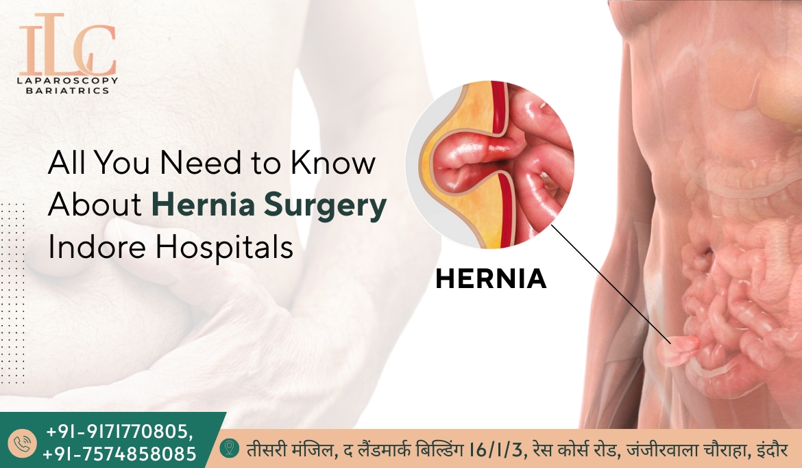 Hernia Surgery in Indore Hospitals