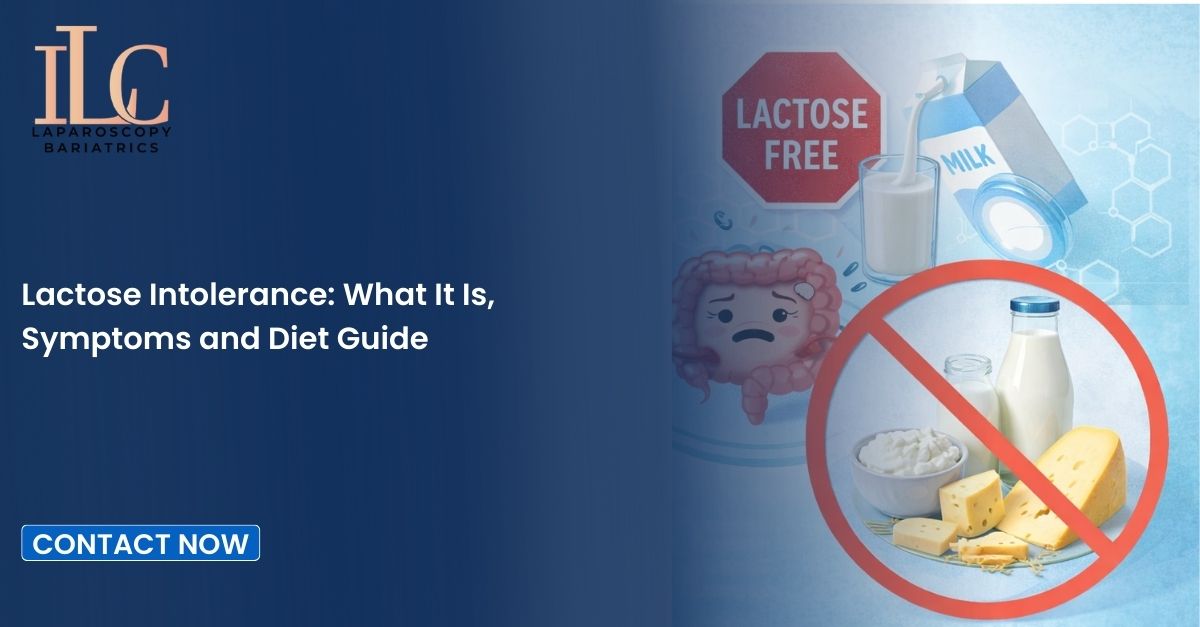 Lactose Intolerance: What It Is, Symptoms and Diet Guide