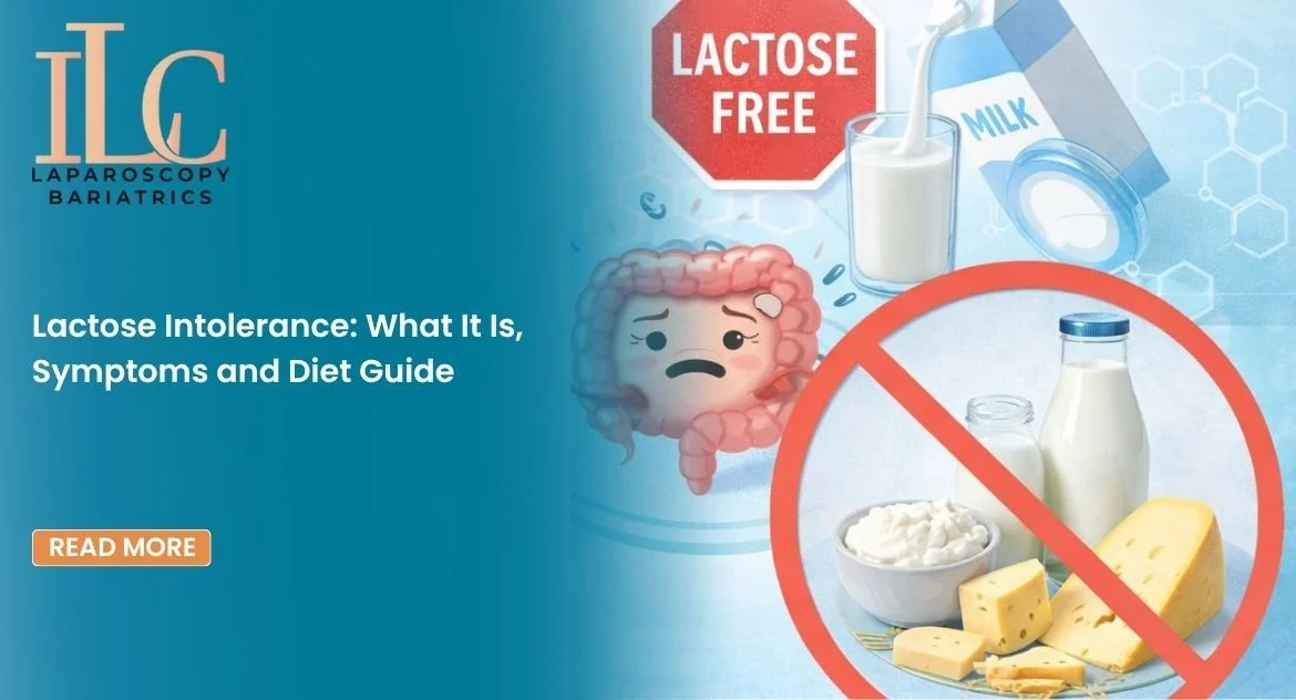 Lactose Intolerance What It Is, Symptoms and Diet Guide