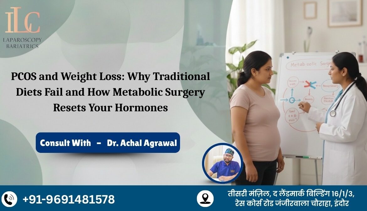 PCOS and Weight Loss