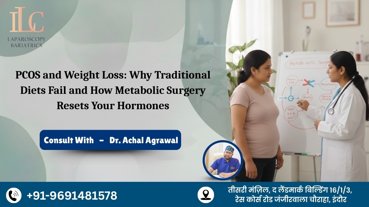 PCOS and Weight Loss