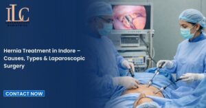 Hernia Treatment in Indore – Causes, Types & Laparoscopic Surgery