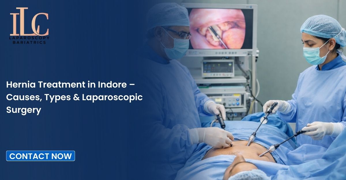 Hernia Treatment in Indore – Causes, Types & Laparoscopic Surgery
