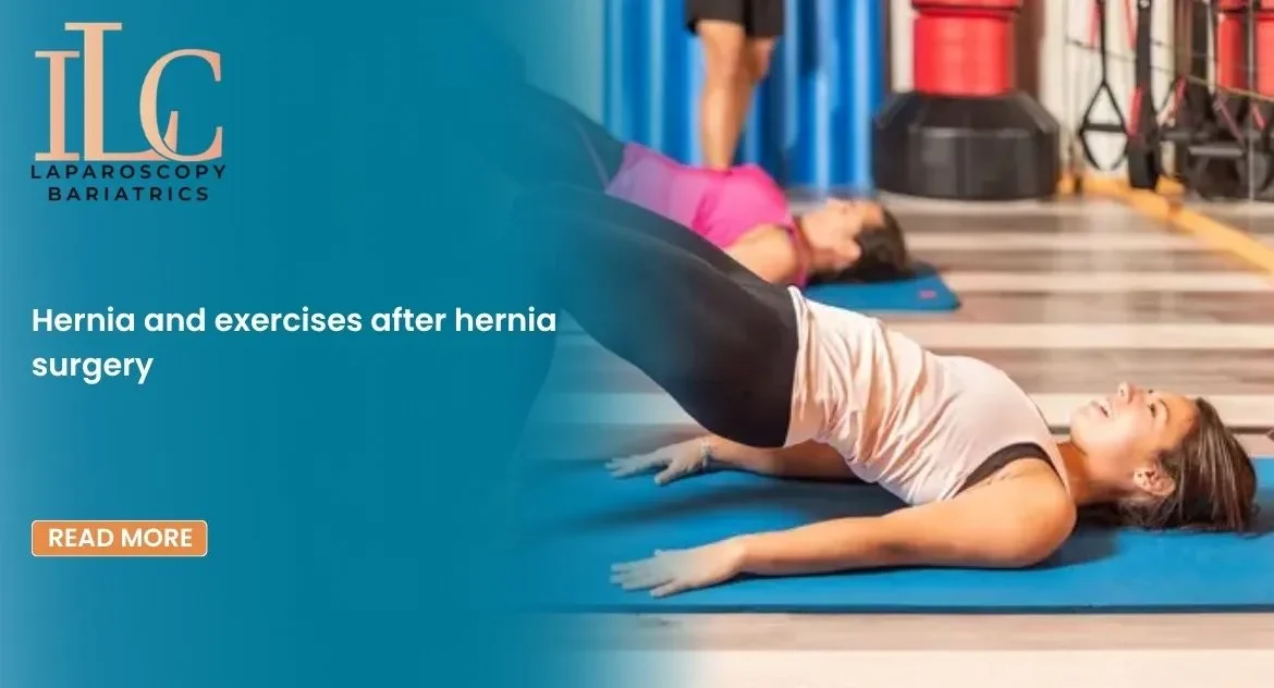 Hernia and exercises after hernia surgery