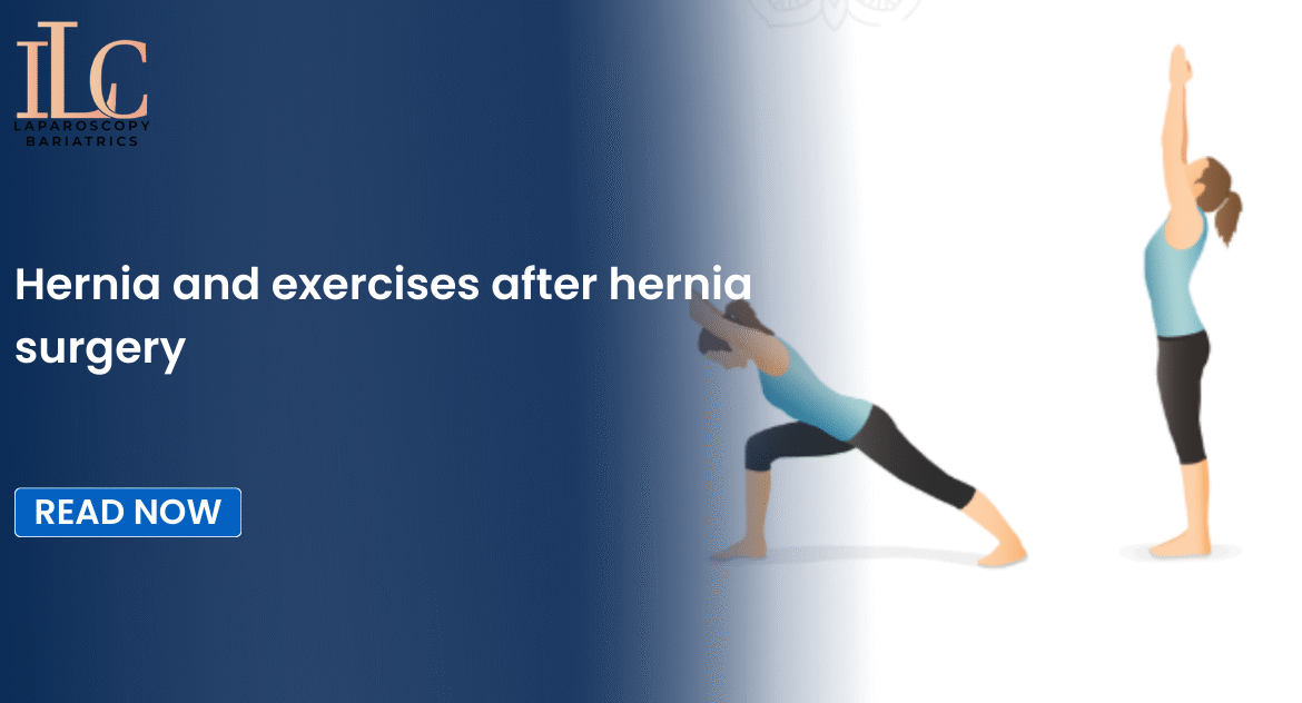 Hernia and exercises after hernia surgery