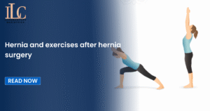 Hernia and exercises after hernia surgery