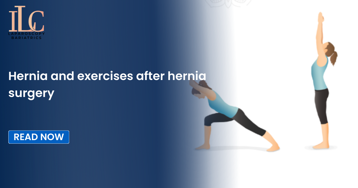 Hernia and exercises after hernia surgery