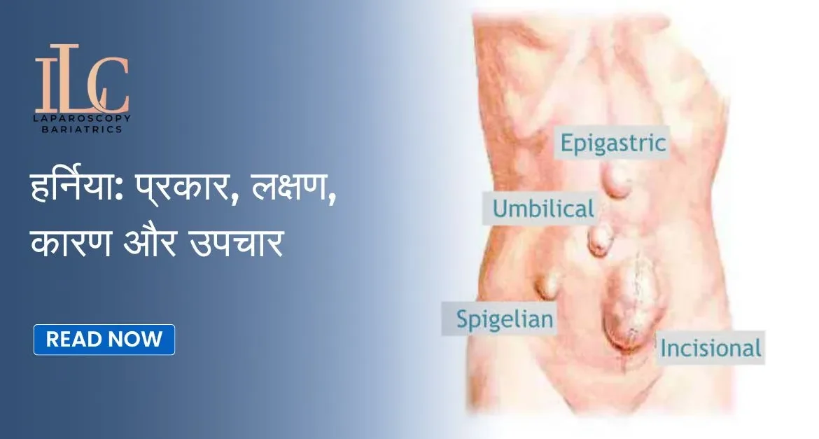 Hernia Types, Symptoms, Causes & Treatment