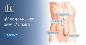 Hernia Types, Symptoms, Causes & Treatment