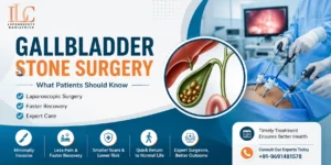 Important Things Patients Should Know Before Gallbladder Stone Surgery 