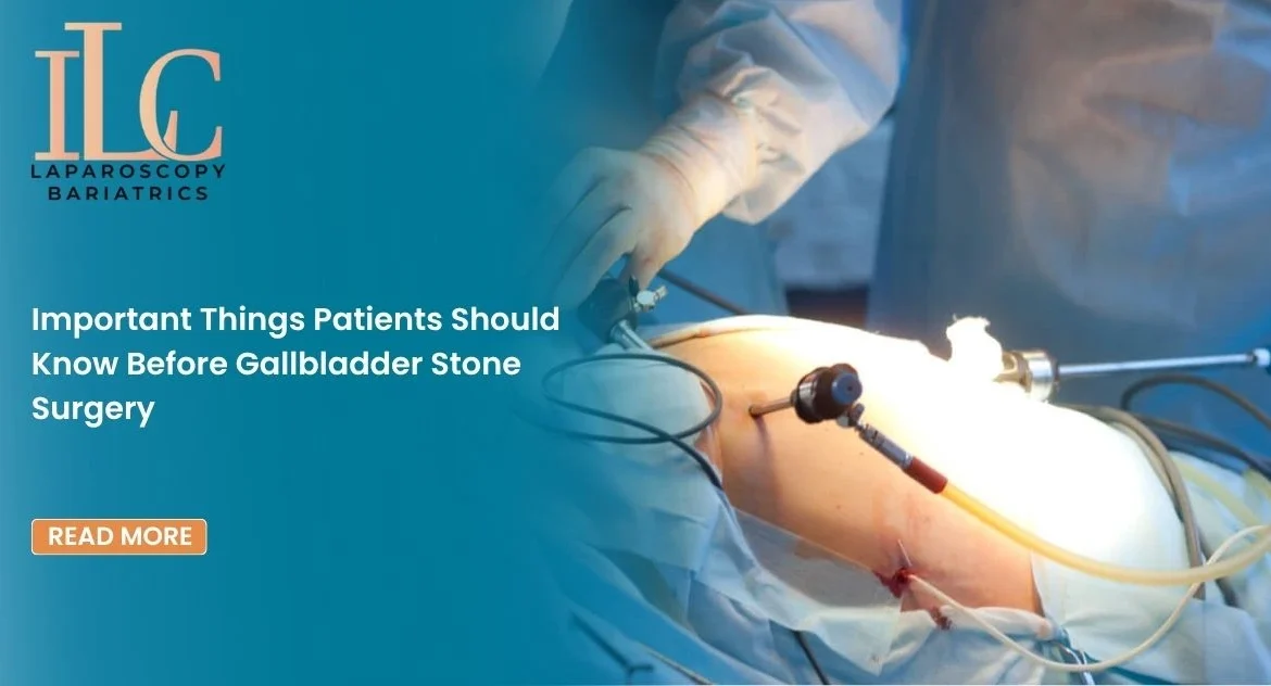 Important Things Patients Should Know Before Gallbladder Stone Surgery