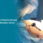 Important Things Patients Should Know Before Gallbladder Stone Surgery