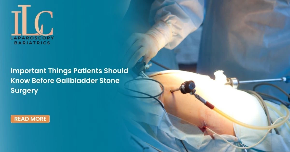 Important Things Patients Should Know Before Gallbladder Stone Surgery