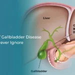 Gallbladder anatomy showing liver bile duct pancreas and gallbladder
