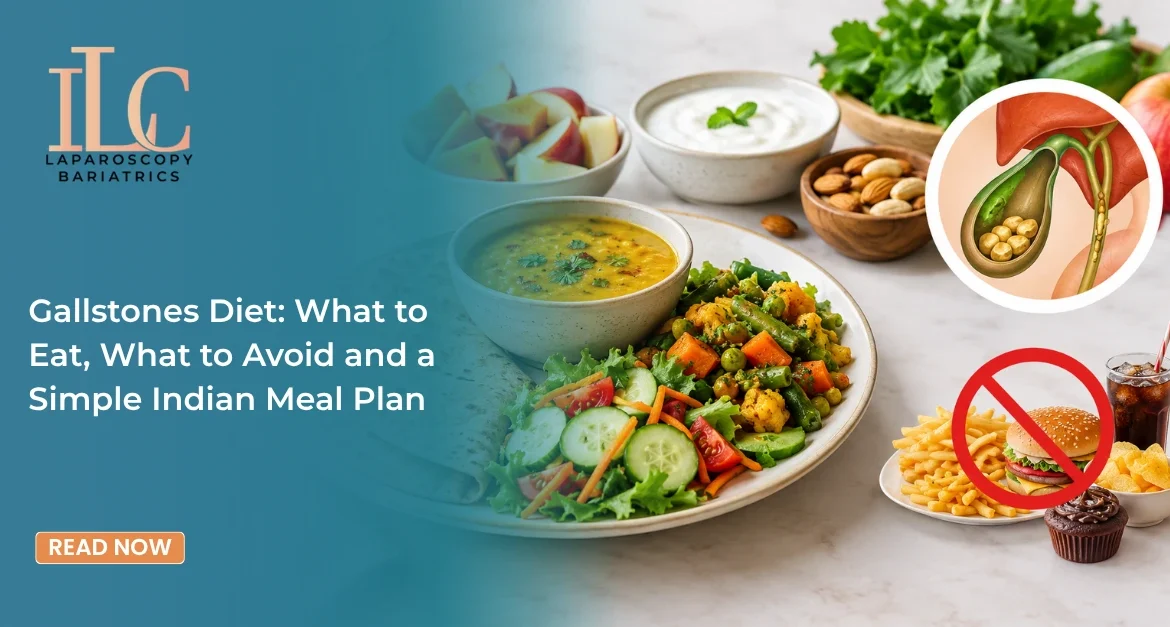 Gallstones diet foods to eat and avoid