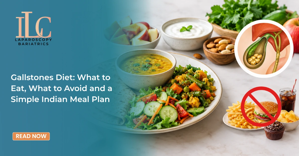 Gallstones diet foods to eat and avoid