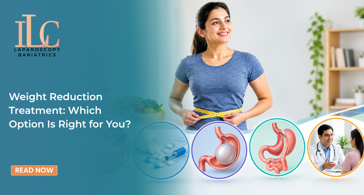 Weight Reduction Treatment: Which Option Is Right for You?